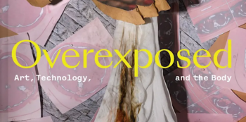 Exhibition &ldquo;Overexposed: Art, Technology, and the Body&rdquo;